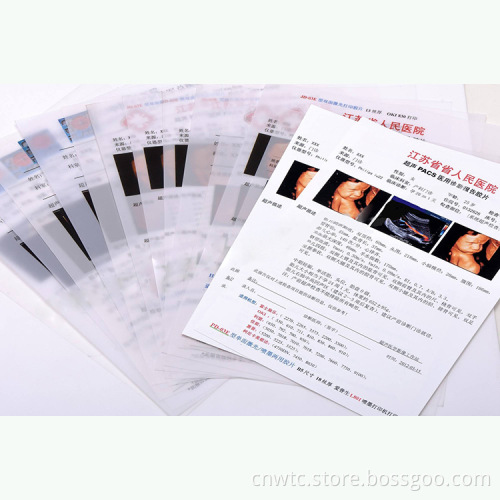 Double-Sided White Medical Laser Film for Ultrasound Imaging and Inkjet Printing